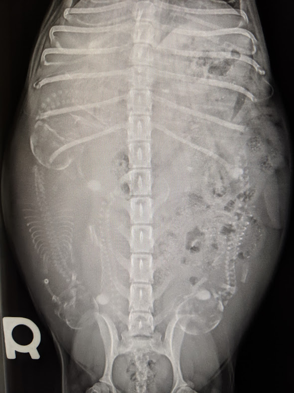 Abdominal X-Ray